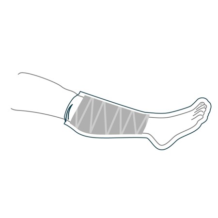 2 - Copri gesso, protezione impermeabile metà  gamba Small: lunghezza 51 cm, circonferenza 24 cm Art. LP20